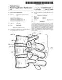 FACET JOINT PROSTHESIS diagram and image