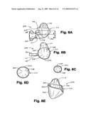 FACET JOINT PROSTHESIS diagram and image