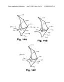 FACET JOINT PROSTHESIS diagram and image