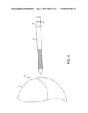 Bone Resurfacing System and Method diagram and image