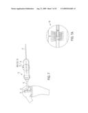 Bone Resurfacing System and Method diagram and image