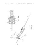 Bone Resurfacing System and Method diagram and image