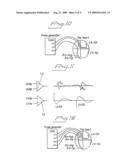 SYSTEM AND METHOD FOR DETECTING ELECTRIC EVENTS IN CHAMBERS OF A HEART diagram and image