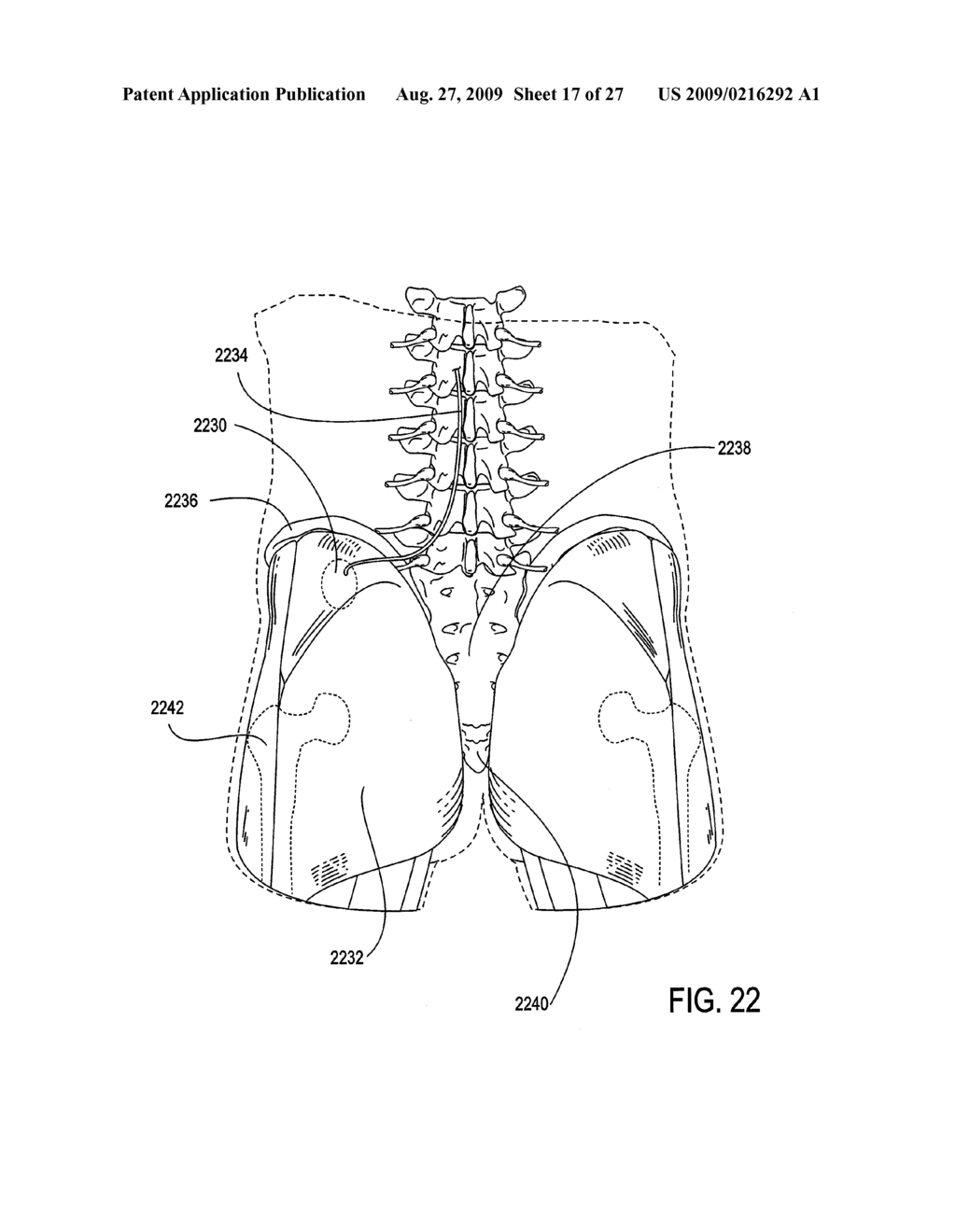 DEVICES, METHODS, AND SYSTEMS FOR HARVESTING ENERGY IN THE BODY - diagram, schematic, and image 18