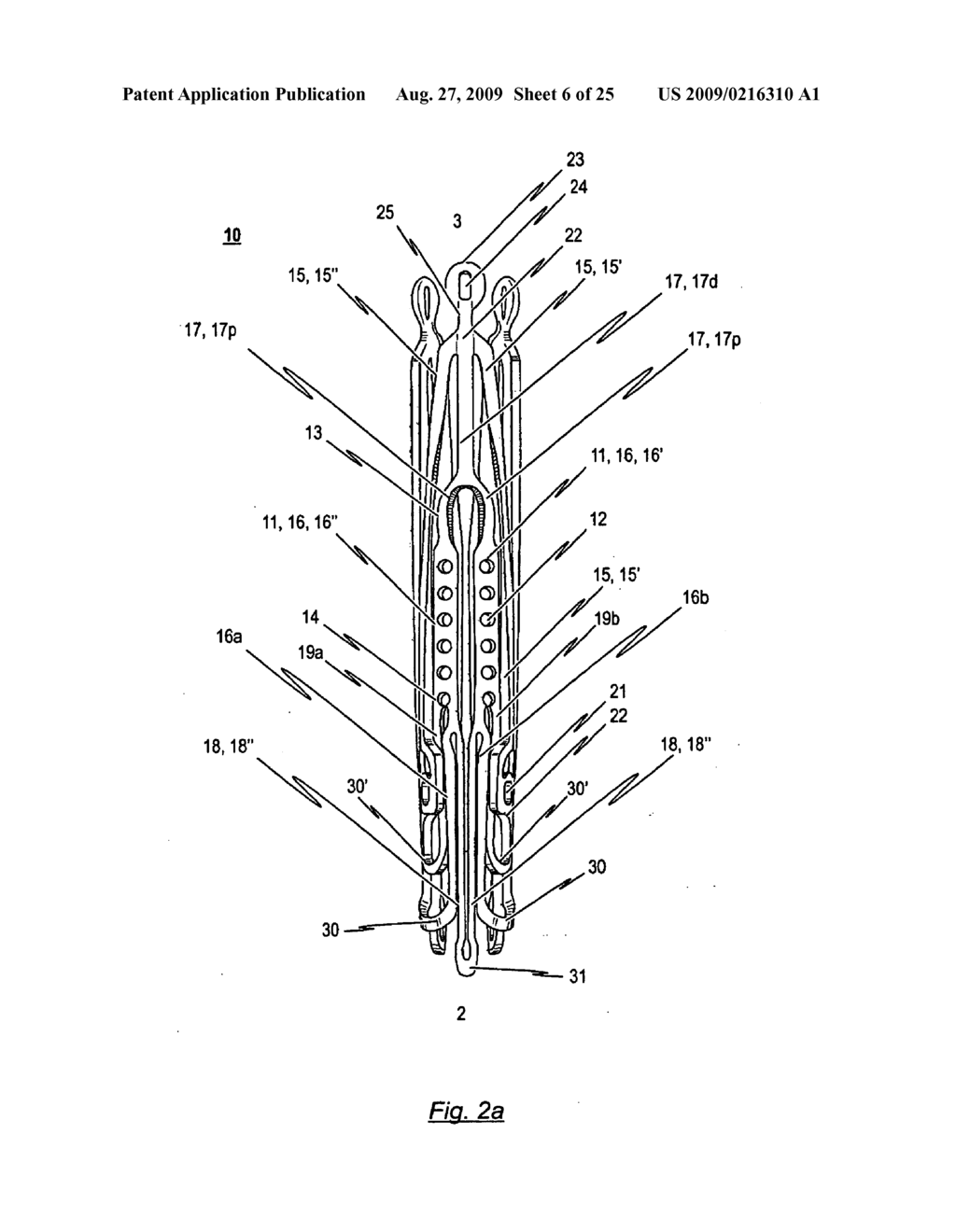 Stent for the positioning and anchoring of a valvular prosthesis in an implantation site in the heart of a patient - diagram, schematic, and image 07