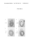 Use of cis-epoxyeicosatrienoic acids and inhibitors of soluble epoxide hydrolase to reduce cardiomyopathy diagram and image