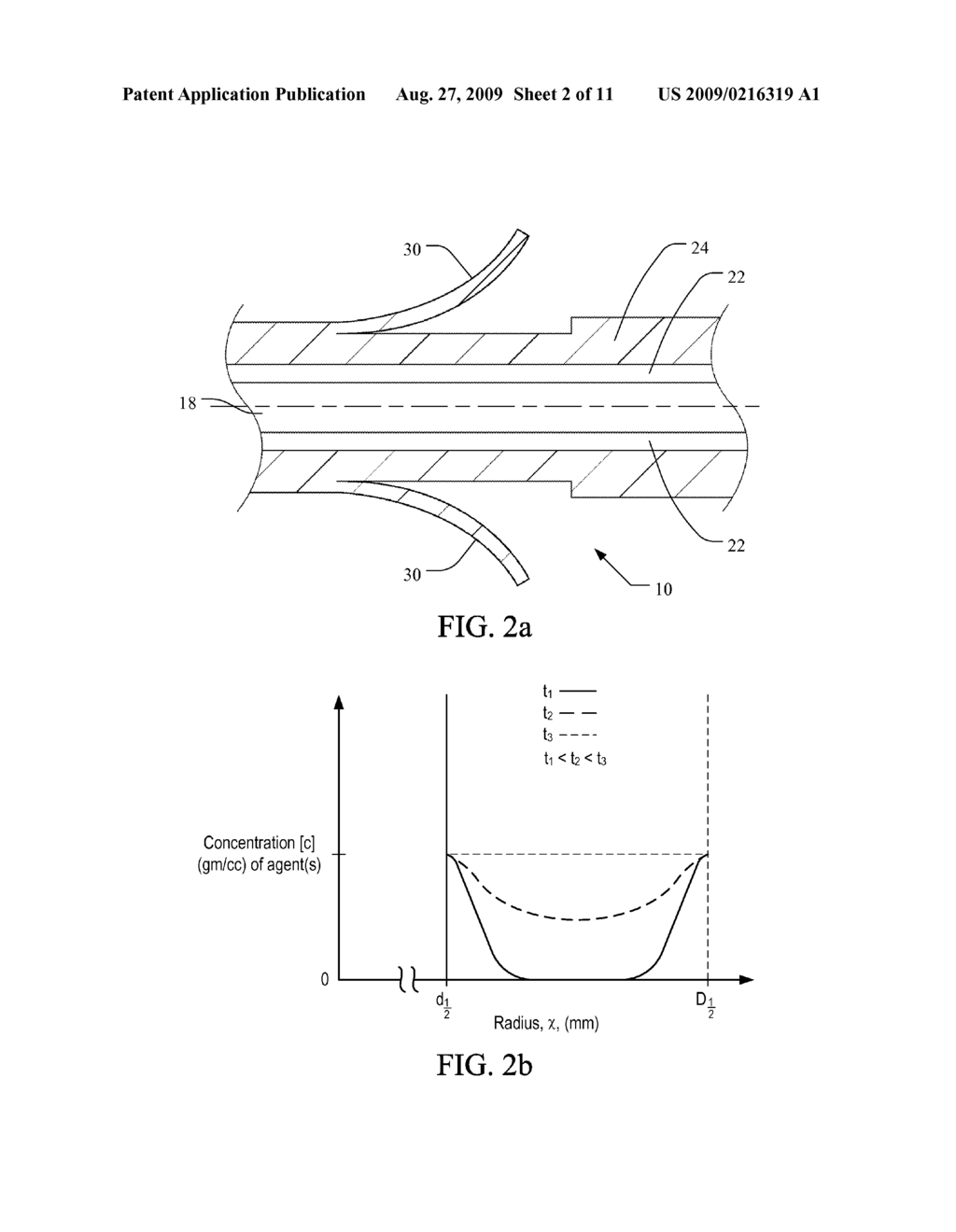 MEDICAL IMPLANT HAVING IMPROVED DRUG ELUTING FEATURES - diagram, schematic, and image 03