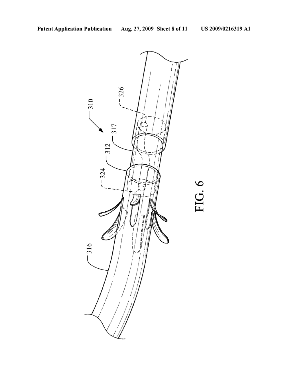 MEDICAL IMPLANT HAVING IMPROVED DRUG ELUTING FEATURES - diagram, schematic, and image 09