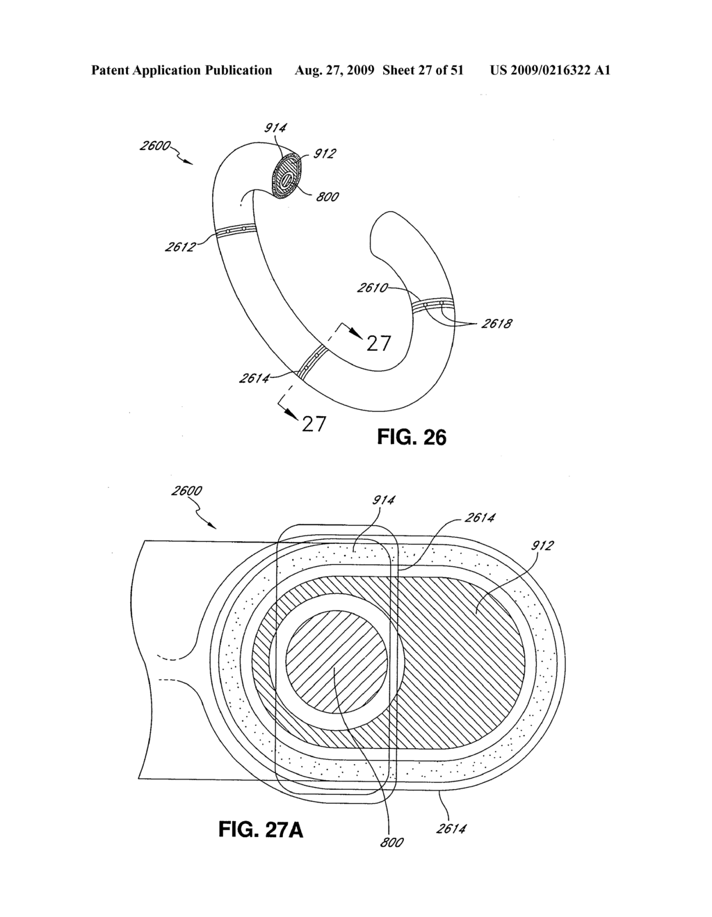 ADJUSTABLE ANNULOPLASTY RING AND ACTIVATION SYSTEM - diagram, schematic, and image 28