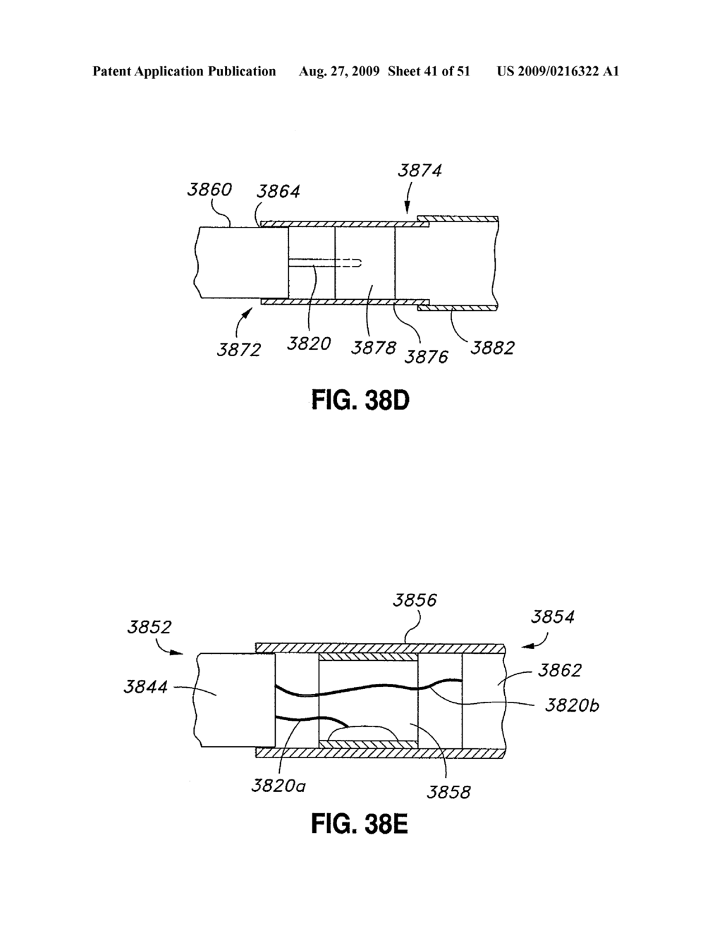 ADJUSTABLE ANNULOPLASTY RING AND ACTIVATION SYSTEM - diagram, schematic, and image 42