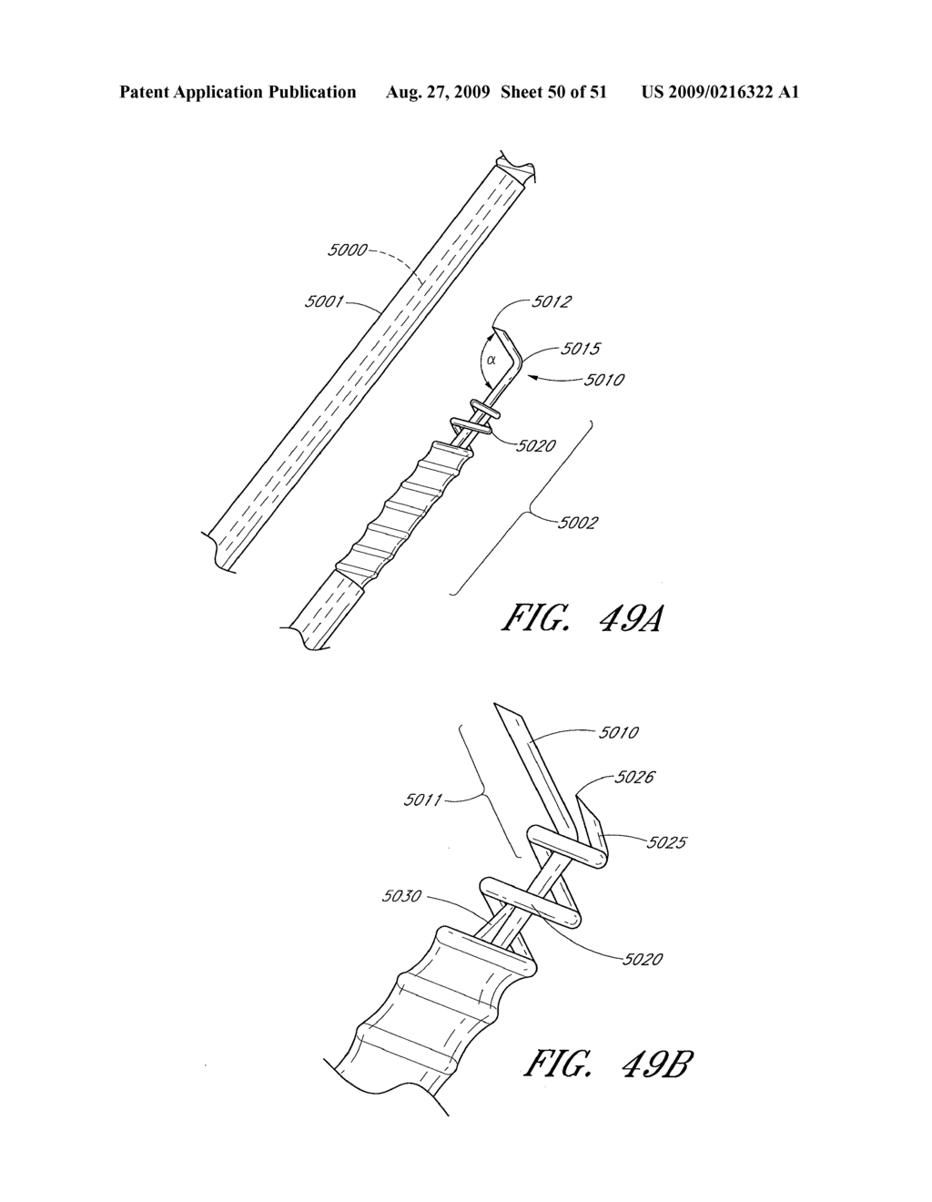 ADJUSTABLE ANNULOPLASTY RING AND ACTIVATION SYSTEM - diagram, schematic, and image 51