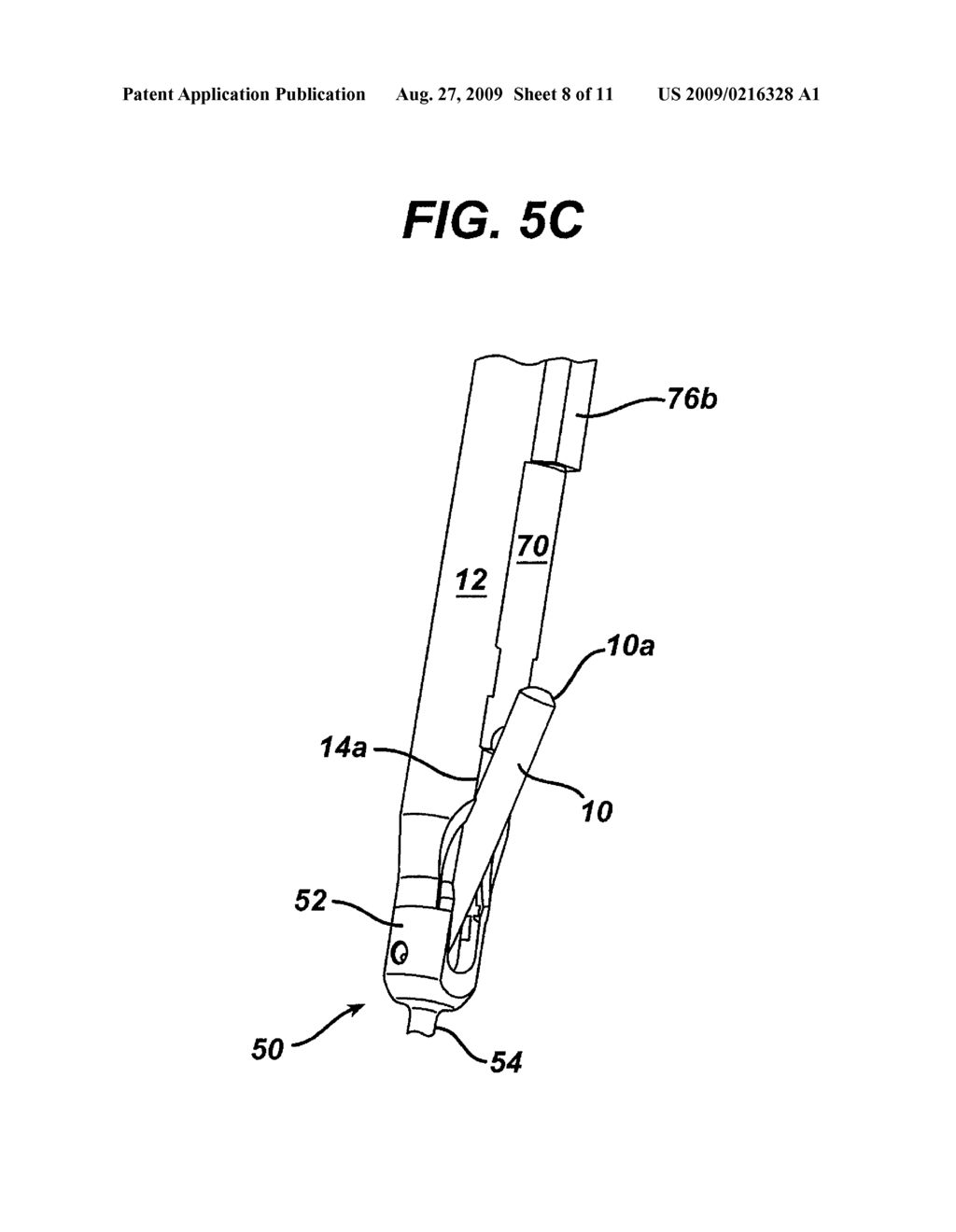 SPINAL FIXATION ELEMENT AND METHODS - diagram, schematic, and image 09