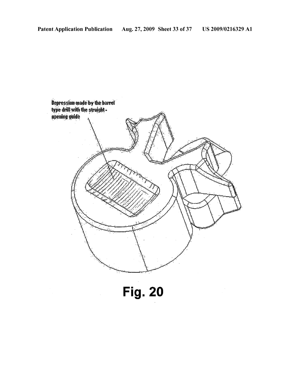 INTERVERTEBRAL DISC REPLACEMENT AND ASSOCIATED INSTRUMENTATION - diagram, schematic, and image 34