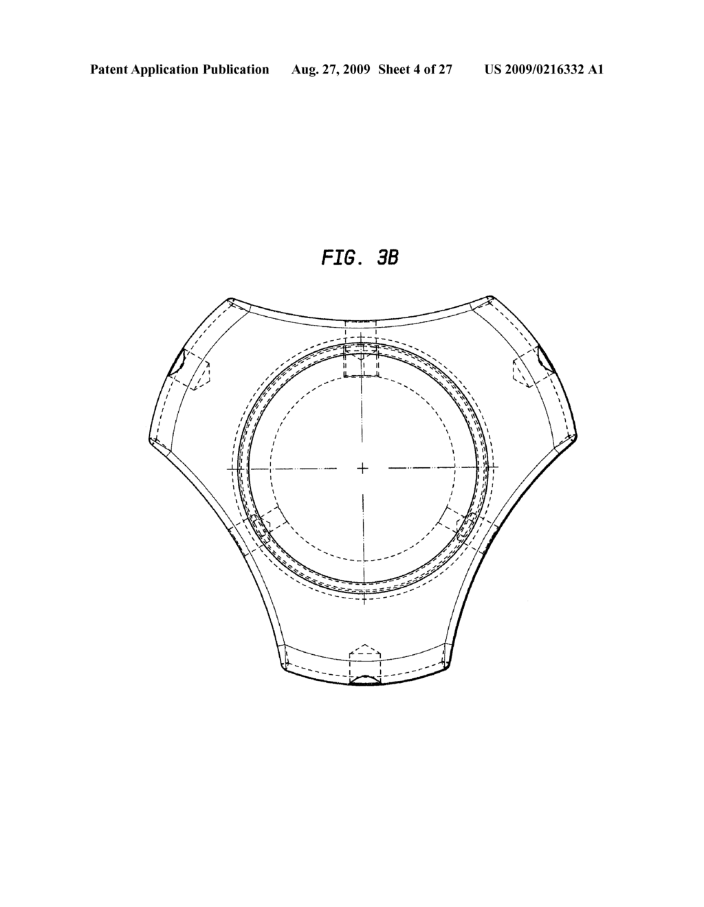 EXPANDABLE REVERSE SHOULDER TRIAL - diagram, schematic, and image 05