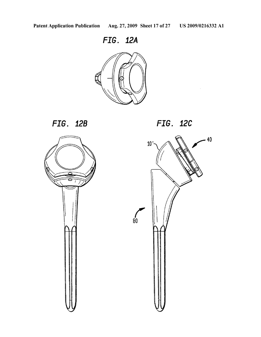 EXPANDABLE REVERSE SHOULDER TRIAL - diagram, schematic, and image 18