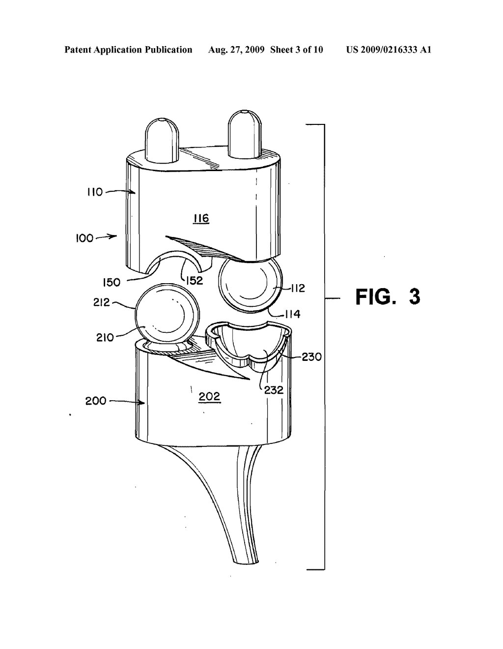 WRIST IMPLANTS - diagram, schematic, and image 04