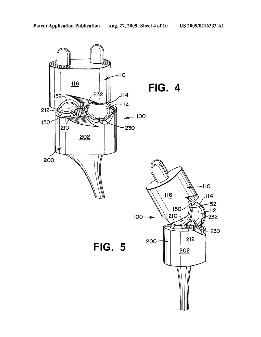 WRIST IMPLANTS - diagram, schematic, and image 05