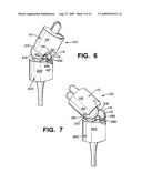 WRIST IMPLANTS diagram and image