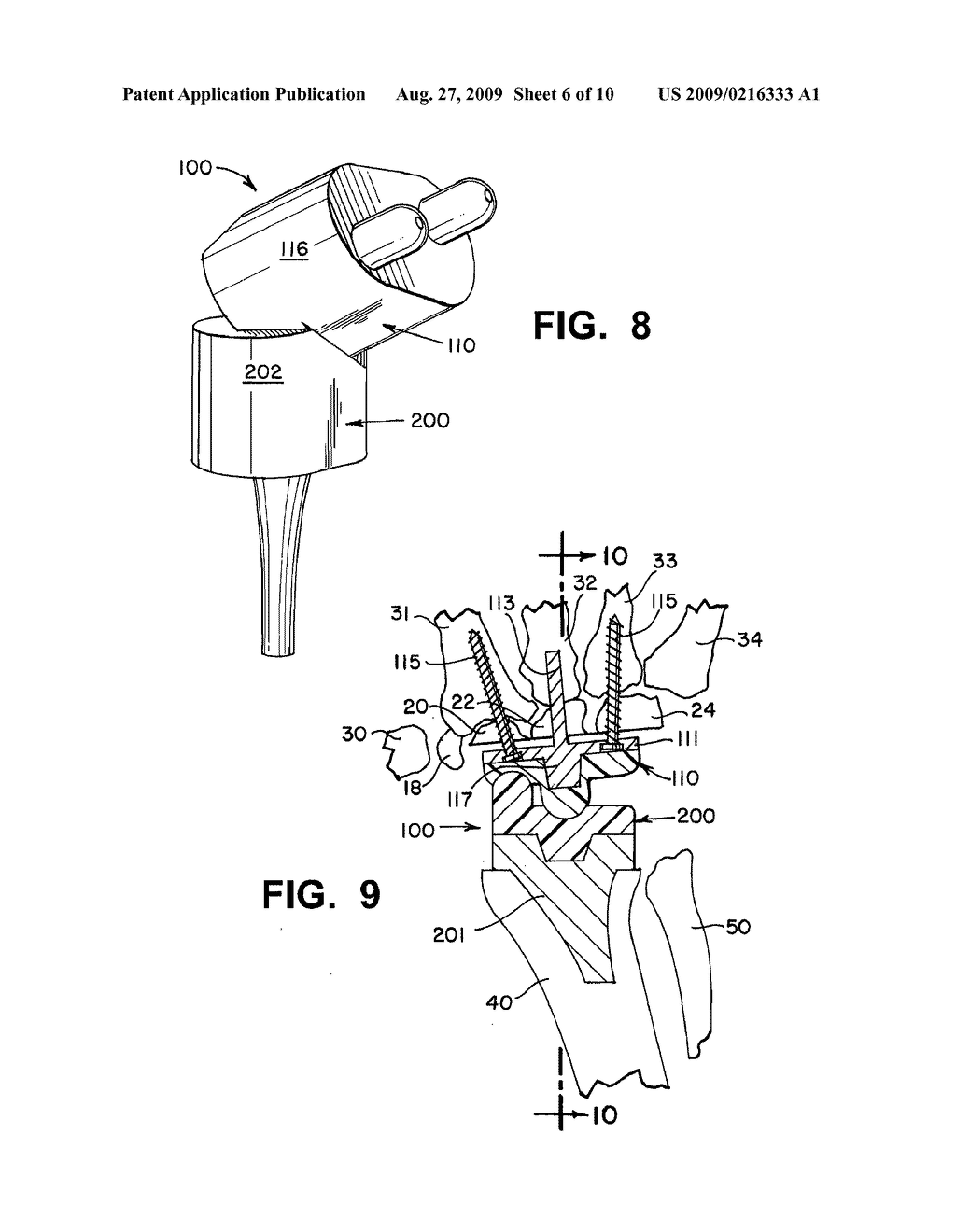 WRIST IMPLANTS - diagram, schematic, and image 07