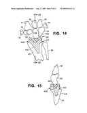 WRIST IMPLANTS diagram and image