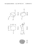 Bone Implants diagram and image