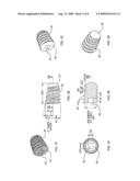 Bone Implants diagram and image