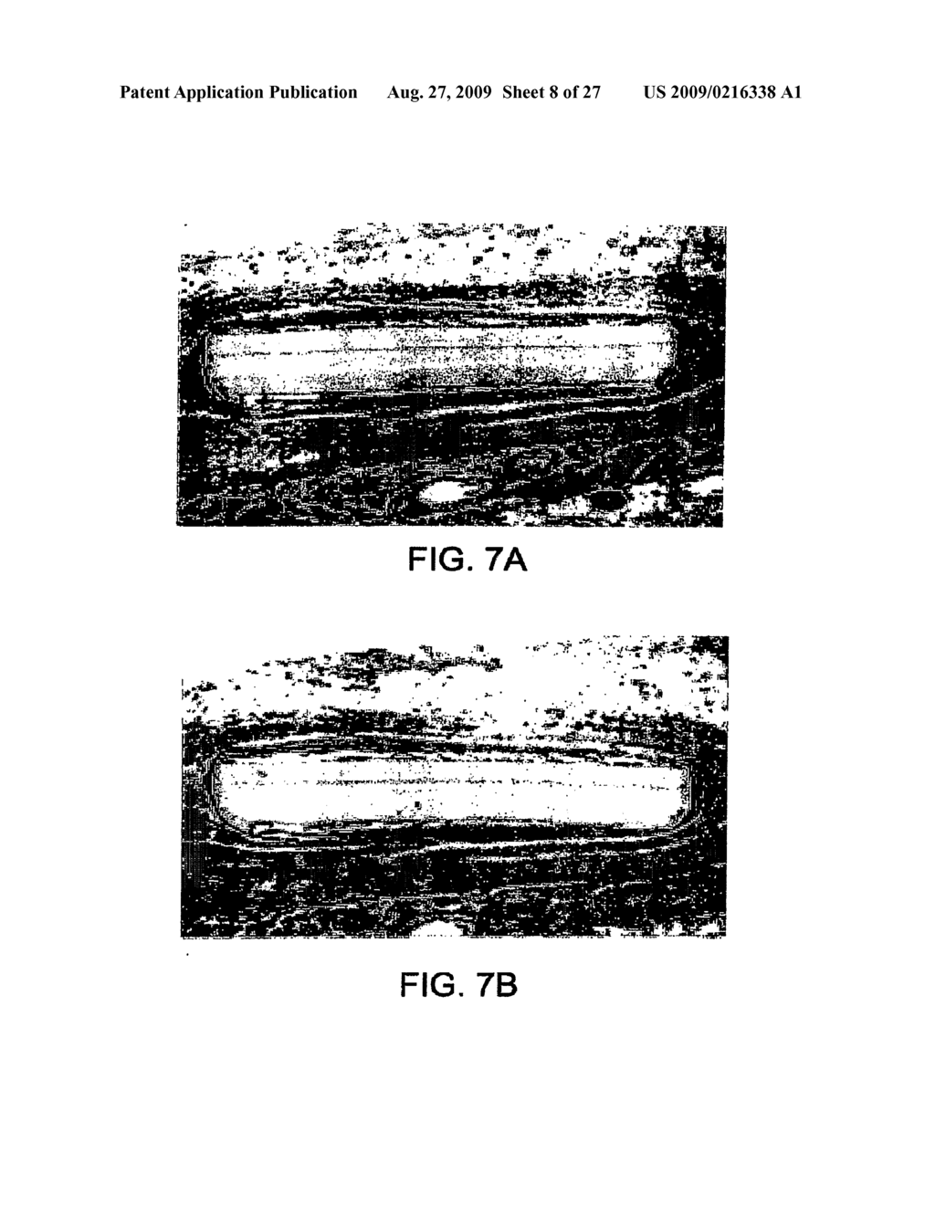 SOFT TISSUE IMPLANTS AND METHODS FOR MAKING SAME - diagram, schematic, and image 09