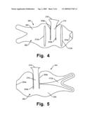 FOOT-SUPPORT STRUCTURES WITH ADDITIONAL SHEAR SUPPORT AND PRODUCTS CONTAINING SUCH SUPPORT STRUCTURES diagram and image