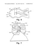 FOOT-SUPPORT STRUCTURES WITH ADDITIONAL SHEAR SUPPORT AND PRODUCTS CONTAINING SUCH SUPPORT STRUCTURES diagram and image