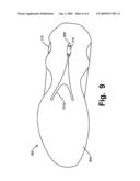 FOOT-SUPPORT STRUCTURES WITH ADDITIONAL SHEAR SUPPORT AND PRODUCTS CONTAINING SUCH SUPPORT STRUCTURES diagram and image