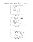 Delivery of Respiratory Therapy diagram and image