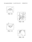 Delivery of Respiratory Therapy diagram and image