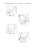 Delivery of Respiratory Therapy diagram and image