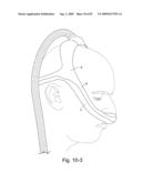 Delivery of Respiratory Therapy diagram and image