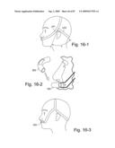 Delivery of Respiratory Therapy diagram and image