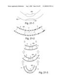 Delivery of Respiratory Therapy diagram and image