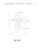 Delivery of Respiratory Therapy diagram and image