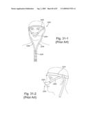 Delivery of Respiratory Therapy diagram and image