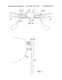 EYEGLASSES diagram and image