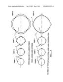 Multi-laser system diagram and image