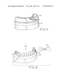 METHOD OF MERGING ANATOMICAL DATA AND SURFACE DATA OF A PATIENT S DENTITION diagram and image