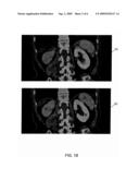 Automatic Multi-label Segmentation Of Abdominal Images Using Non-Rigid Registration diagram and image