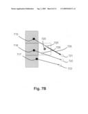 Method and apparatus for registration of an atlas to an image diagram and image