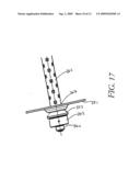 Self Drilling Rock Bolt diagram and image