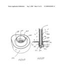 Self Drilling Rock Bolt diagram and image