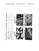 DEFECTIVE RIBOSOMAL PRODUCTS IN BLEBS (DRIBBLES) AND METHODS OF USE TO STIMULATE AN IMMUNE RESPONSE diagram and image