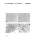 METHOD FOR PRODUCING AUTONOMOUSLY CONTRACTING CARDIAC MUSCLE CELLS FROM ADULT STEM CELLS, IN PARTICULAR HUMAN ADULT STEM CELLS diagram and image