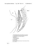 METHOD FOR PRODUCING AUTONOMOUSLY CONTRACTING CARDIAC MUSCLE CELLS FROM ADULT STEM CELLS, IN PARTICULAR HUMAN ADULT STEM CELLS diagram and image