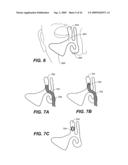 SELF-EXPANDING DEVICES AND METHODS THEREFOR diagram and image