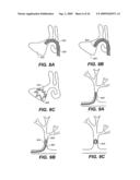 SELF-EXPANDING DEVICES AND METHODS THEREFOR diagram and image